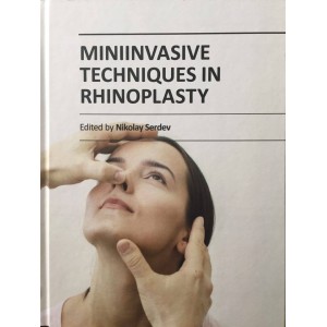 Miniinvasive Techniques in Rhinoplasty