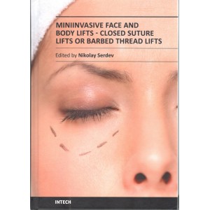 Miniinvasive Face and Body Lifts - Closed Suture Lifts or Barbed Thread Lifts