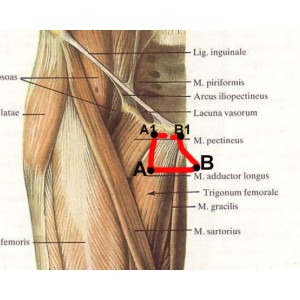 Inner Thigh Lift Instructions + Video